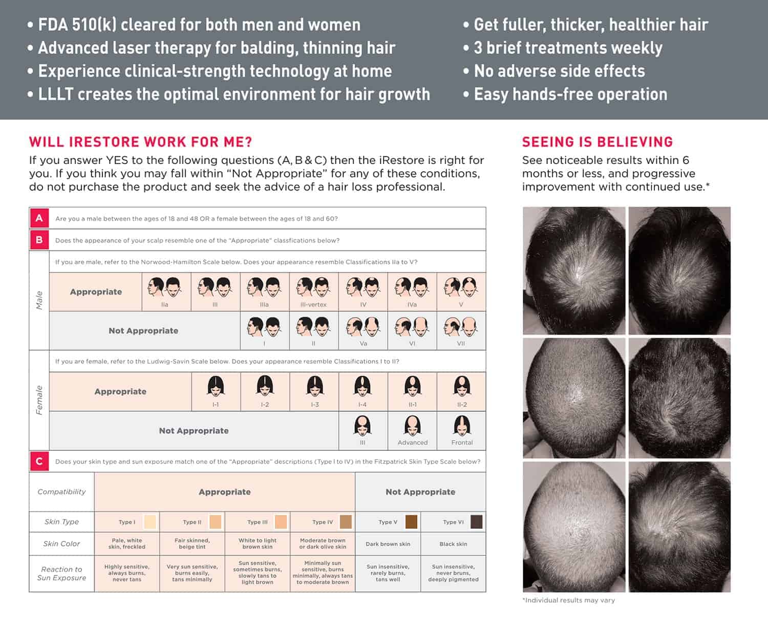 low level laser therapy hair loss solutions for men