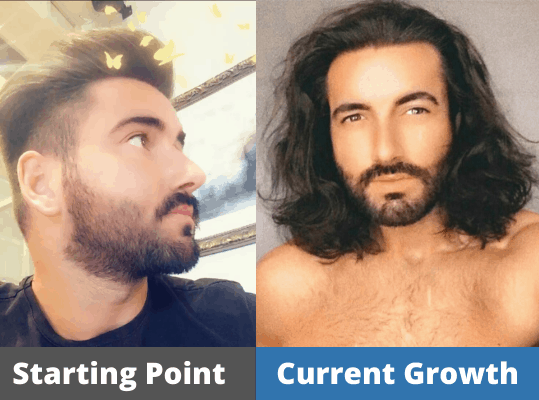 Craigs Long Hair Growth