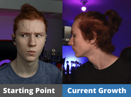 James' Hair growth Journey