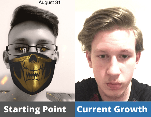 Mason's Hair growth Journey