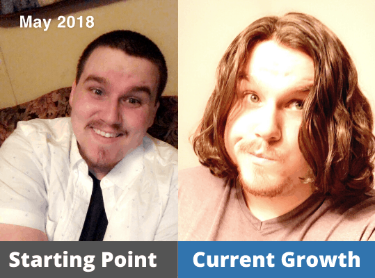 Taylor's Hair growth Journey